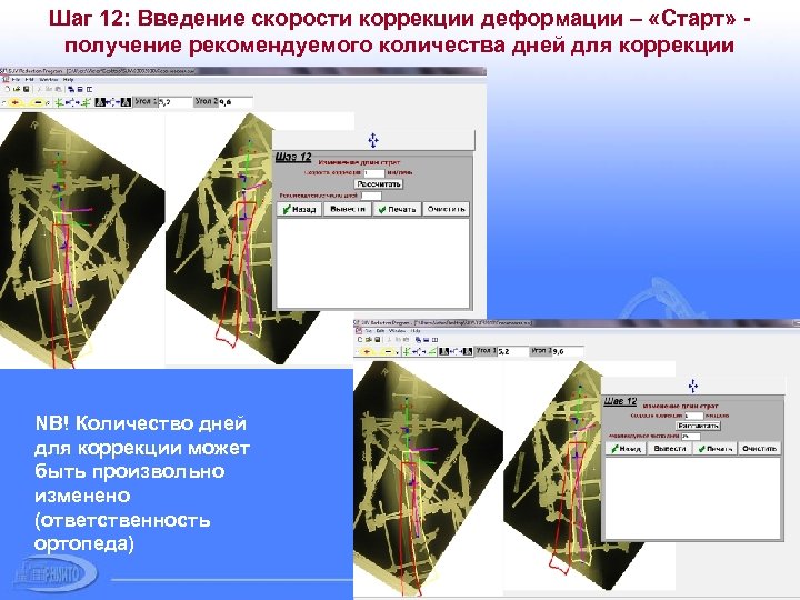 Шаг 12: Введение скорости коррекции деформации – «Старт» получение рекомендуемого количества дней для коррекции