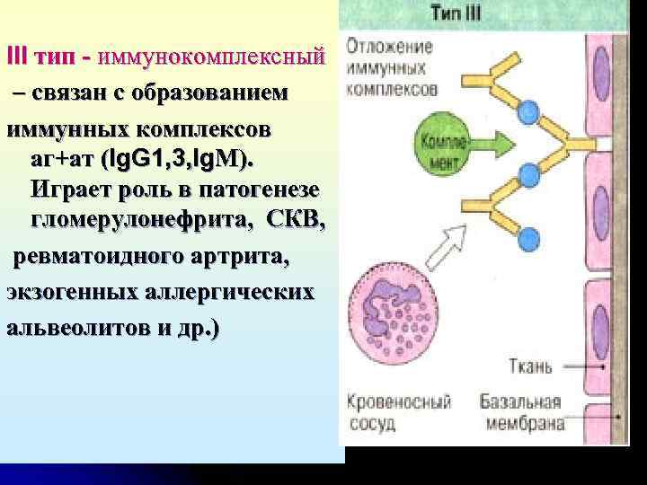 III тип - иммунокомплексный – связан с образованием иммунных комплексов аг+ат (Ig. G 1,