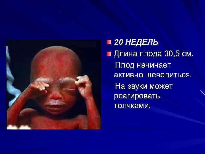 20 НЕДЕЛЬ Длина плода 30, 5 см. Плод начинает активно шевелиться. На звуки может