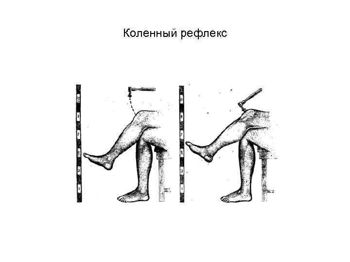 Рефлексы спинного мозга коленный