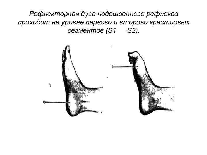 Схема ахиллова рефлекса с указанием звеньев