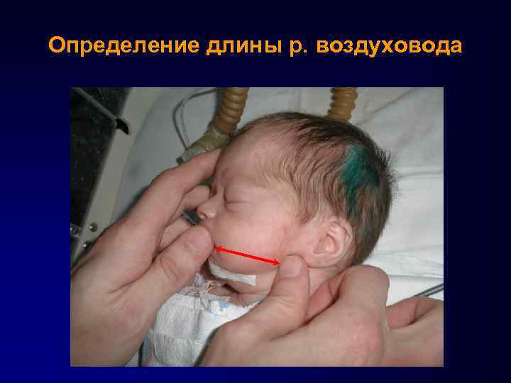 Определение длины р. воздуховода 