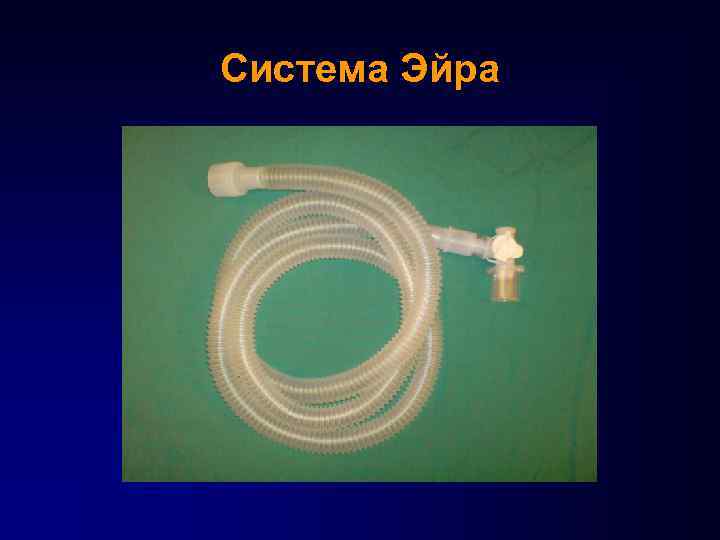 Система Эйра 