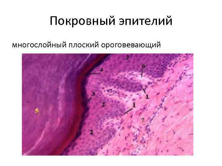 Покровный эпителий многослойный плоский ороговевающий 