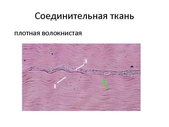 Соединительная ткань плотная волокнистая 