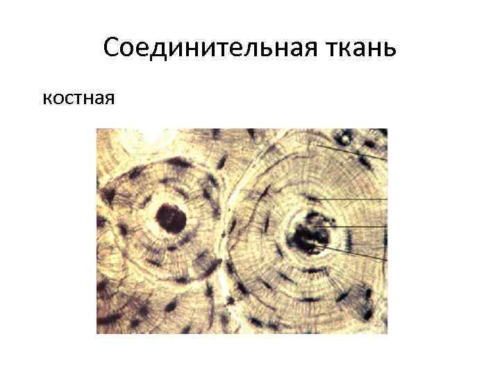 Соединительная ткань костная 