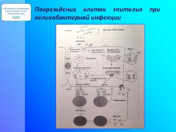 Повреждение клеток эпителия при хеликобактерной инфекции 