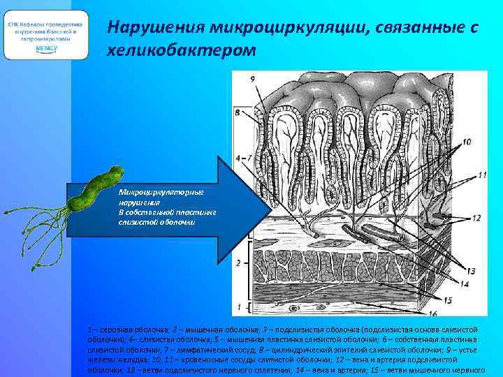 Нарушения микроциркуляции, связанные с хеликобактером Микроциркуляторные нарушения В собственной пластинке слизистой оболочки 1 –