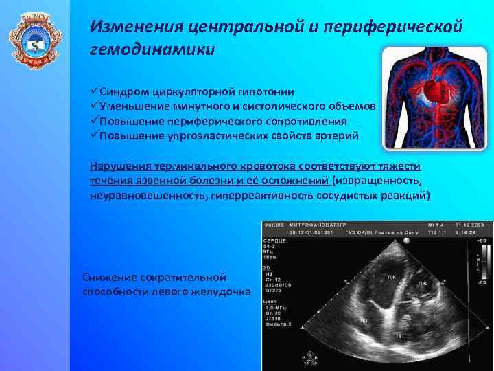 Изменения центральной и периферической гемодинамики üСиндром циркуляторной гипотонии üУменьшение минутного и систолического объемов üПовышение