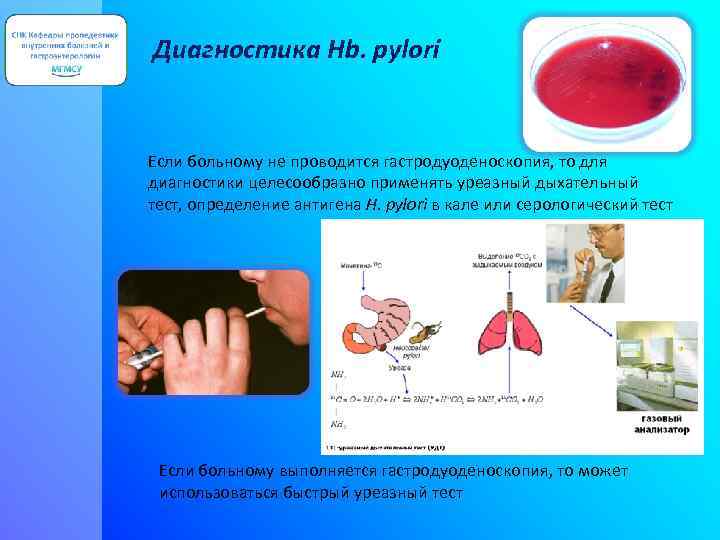 Диагностика Hb. pylori Если больному не проводится гастродуоденоскопия, то для диагностики целесообразно применять уреазный