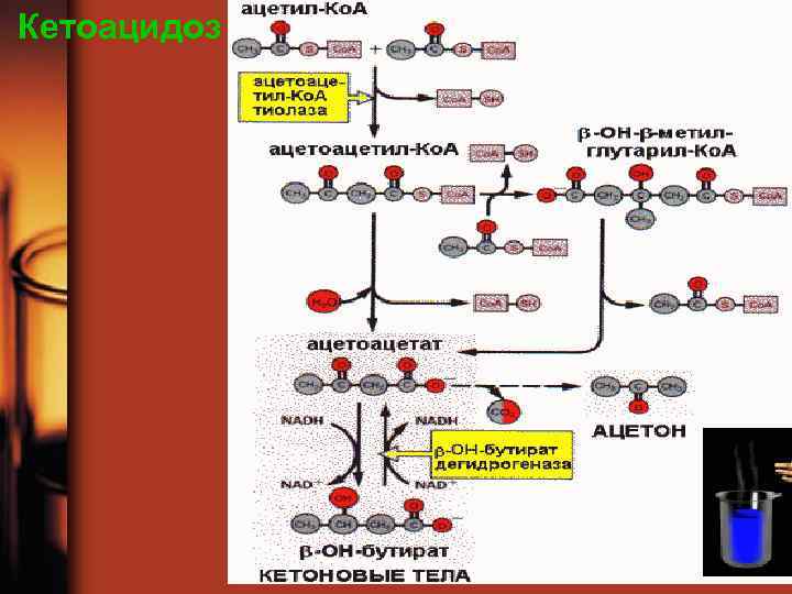 Кетоацидоз 