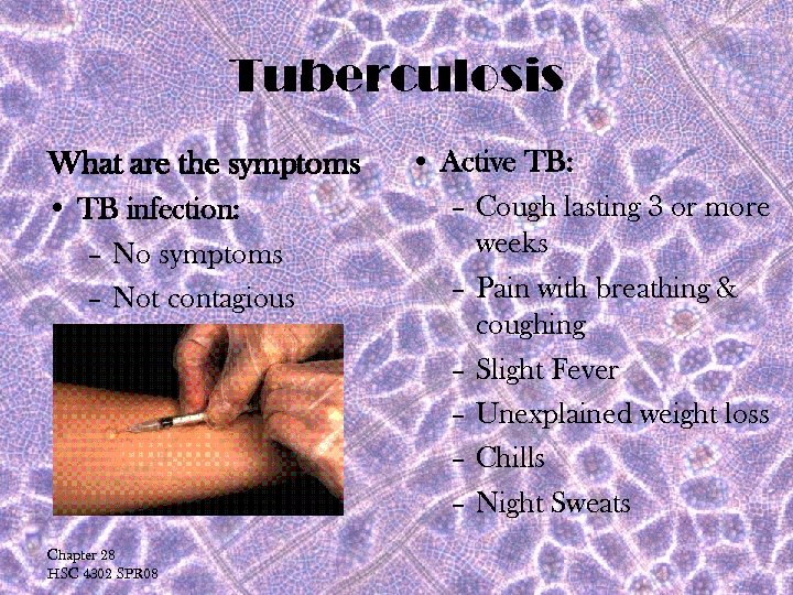 Tuberculosis What are the symptoms • TB infection: – No symptoms – Not contagious