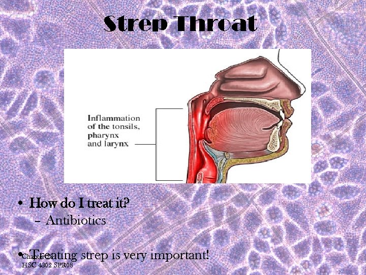 Strep Throat • How do I treat it? – Antibiotics Chapter 28 • Treating