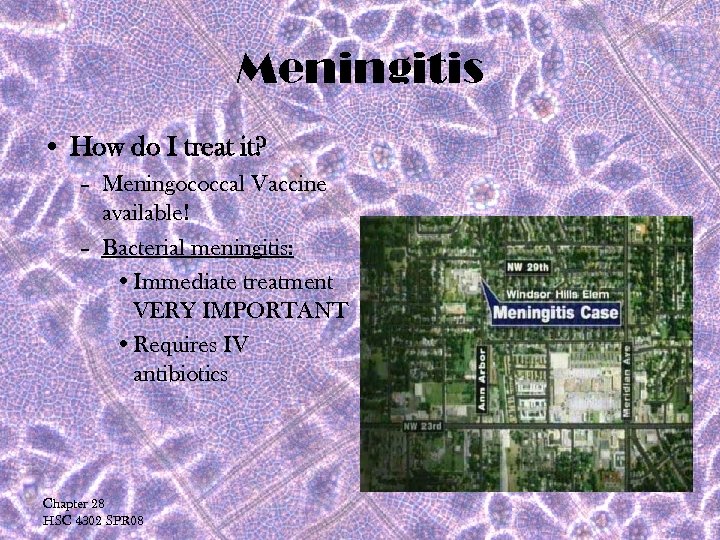 Meningitis • How do I treat it? – Meningococcal Vaccine available! – Bacterial meningitis: