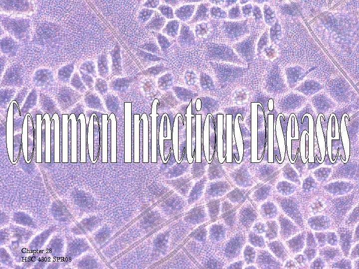 Chapter 28 HSC 4302 SPR 08 