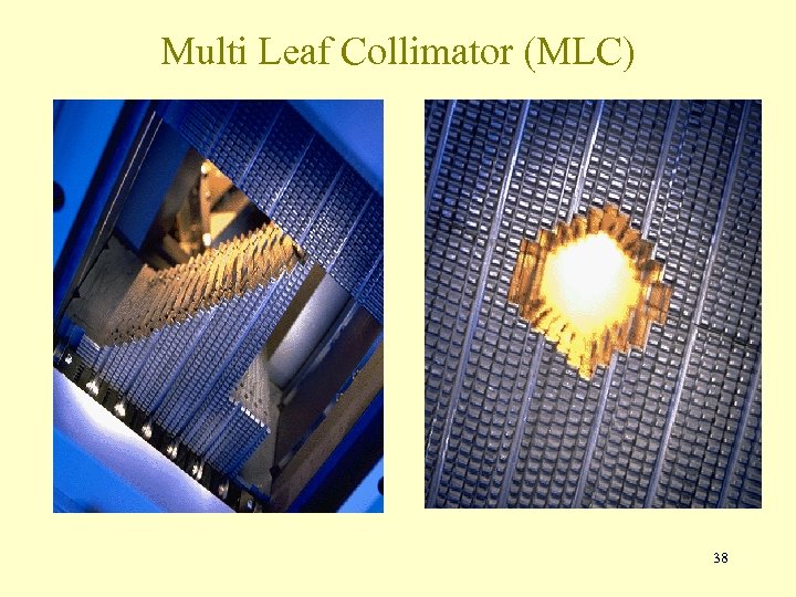 Multi Leaf Collimator (MLC) 38 