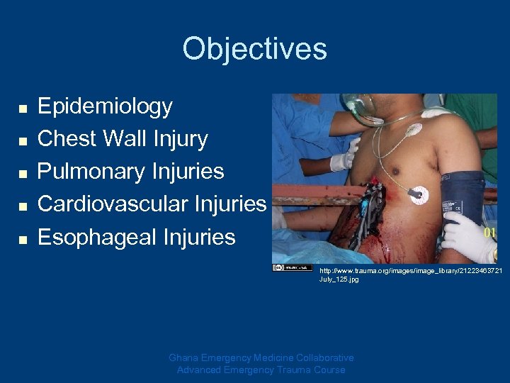 Objectives n n n Epidemiology Chest Wall Injury Pulmonary Injuries Cardiovascular Injuries Esophageal Injuries
