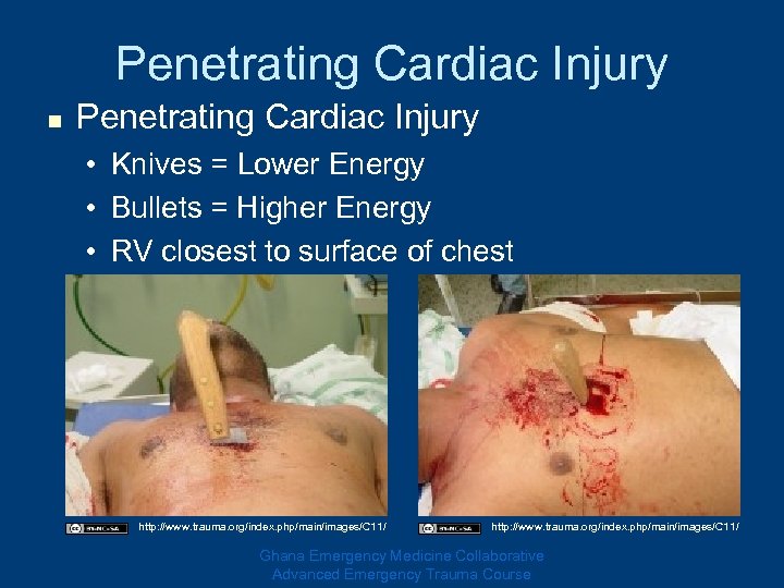 Penetrating Cardiac Injury n Penetrating Cardiac Injury • Knives = Lower Energy • Bullets
