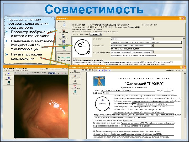 Совместимость Перед заполнением протокола кольпоскопии предусмотрено: Просмотр изображения, снятого с кольпоскопа Нанесение схематичного изображения