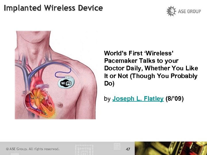 Implanted Wireless Device World's First ‘Wireless' Pacemaker Talks to your Doctor Daily, Whether You