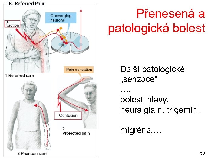 Přenesená a patologická bolest Další patologické „senzace“ …, bolesti hlavy, neuralgia n. trigemini, migréna,