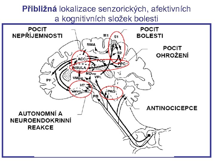 Přibližná lokalizace senzorických, afektivních a kognitivních složek bolesti 60 