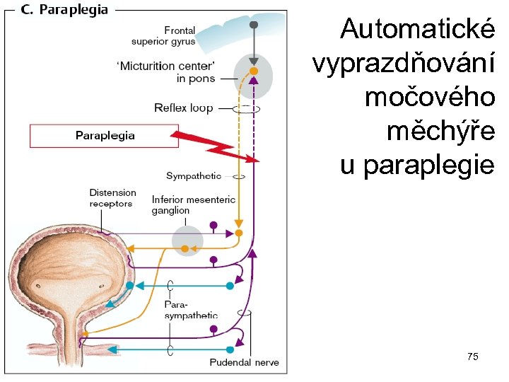 Automatické vyprazdňování močového měchýře u paraplegie 75 