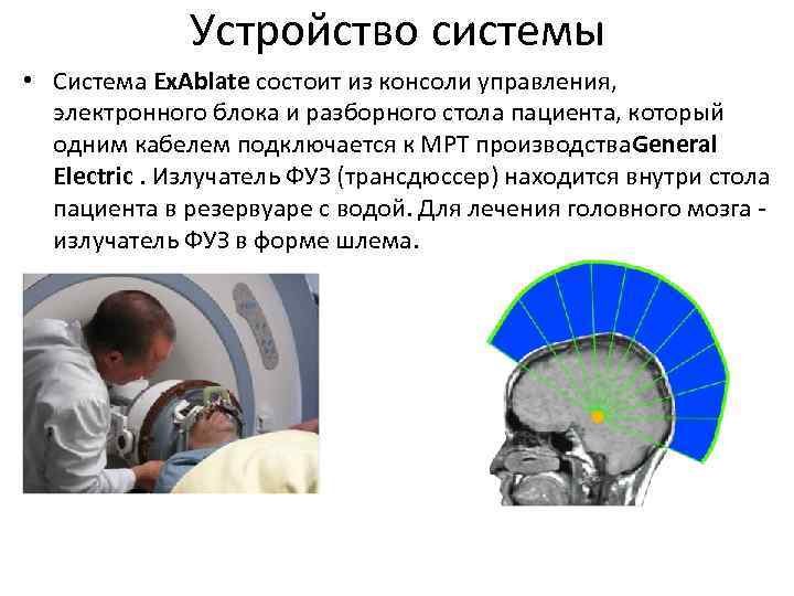 Устройство системы • Система Ex. Ablate состоит из консоли управления, электронного блока и разборного