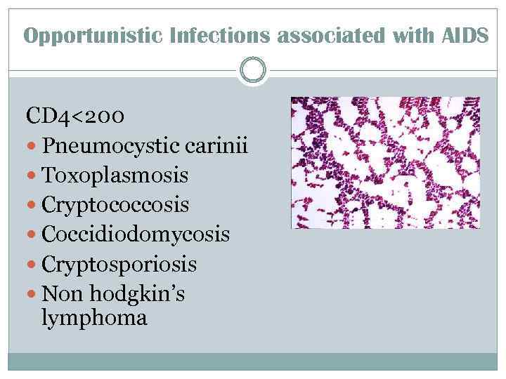 Opportunistic Infections associated with AIDS CD 4<200 Pneumocystic carinii Toxoplasmosis Cryptococcosis Coccidiodomycosis Cryptosporiosis Non