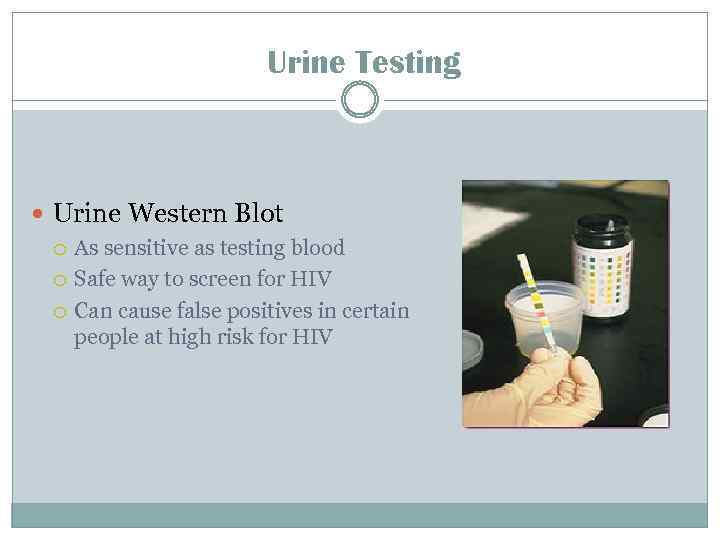 Urine Testing Urine Western Blot As sensitive as testing blood Safe way to screen