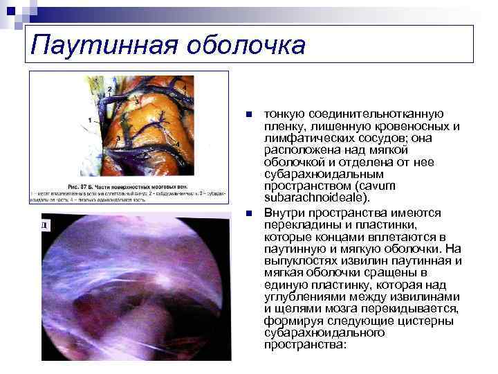 Паутинная оболочка n n тонкую соединительнотканную пленку, лишенную кровеносных и лимфатических сосудов; она расположена