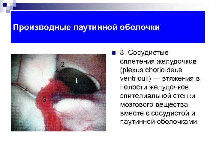 Производные паутинной оболочки n 3. Сосудистые сплетения желудочков (plexus chorioideus ventriculi) — втяжения в