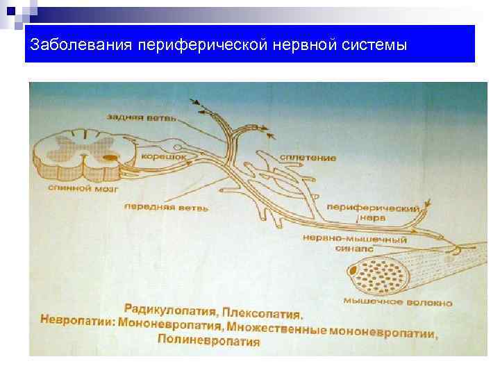 Заболевания периферической нервной системы 