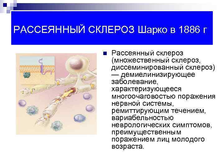 РАССЕЯННЫЙ СКЛЕРОЗ Шарко в 1886 г n Рассеянный склероз (множественный склероз, диссеминированный склероз) —