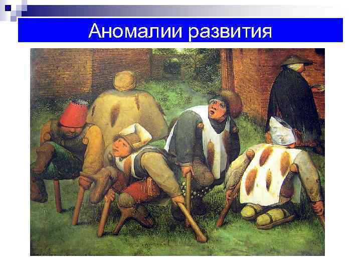 Аномалии развития 