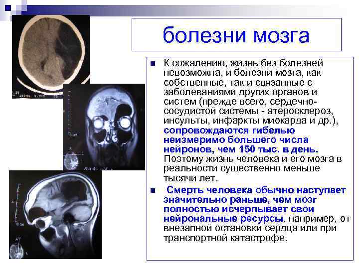 Перечень заболеваний мозга. Болезни головного мозга названия список.