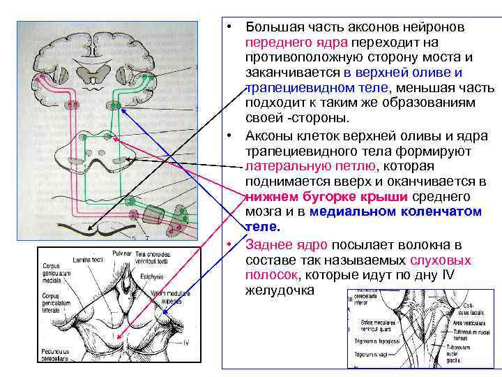 Трапециевидное тело