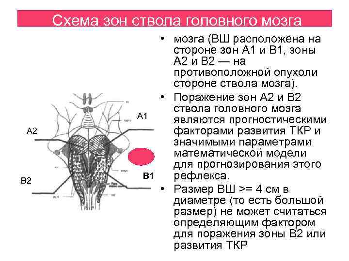 Схема зон ствола головного мозга А 1 А 2 В 1 • мозга (ВШ