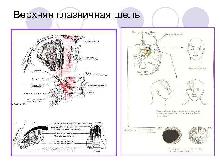 Верхняя глазничная щель