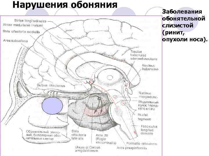 Нарушения обоняния Заболевания обонятельной слизистой (ринит, опухоли носа). 