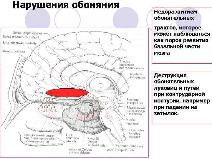 Нарушения обоняния Недоразвитием обонятельных трактов, которое может наблюдаться как порок развития базальной части мозга