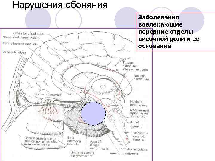 Нарушения обоняния Заболевания вовлекающие передние отделы височной доли и ее основание 