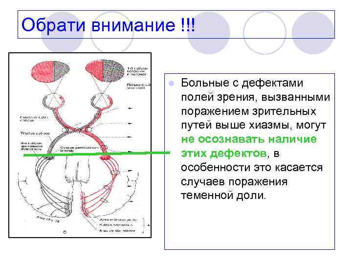 Обрати внимание !!! l Больные с дефектами полей зрения, вызванными поражением зрительных путей выше