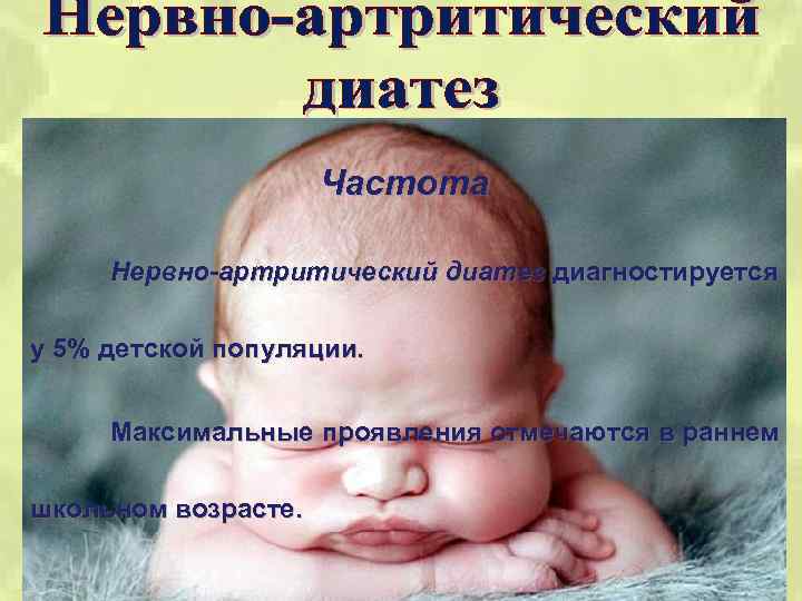Частота Нервно-артритический диатез диагностируется у 5% детской популяции. Максимальные проявления отмечаются в раннем школьном