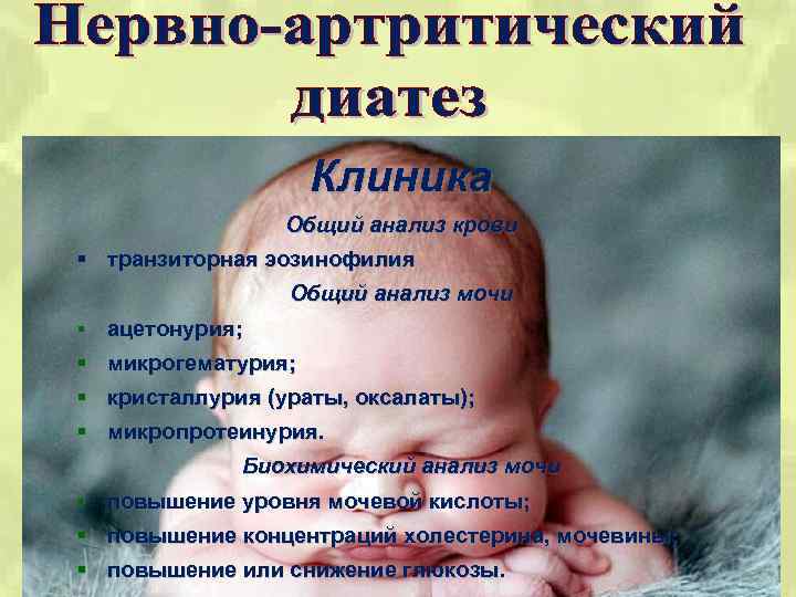 Клиника Общий анализ крови § транзиторная эозинофилия Общий анализ мочи § ацетонурия; § микрогематурия;