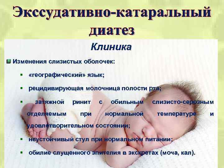 Профилактика экссудативно катарального диатеза презентация