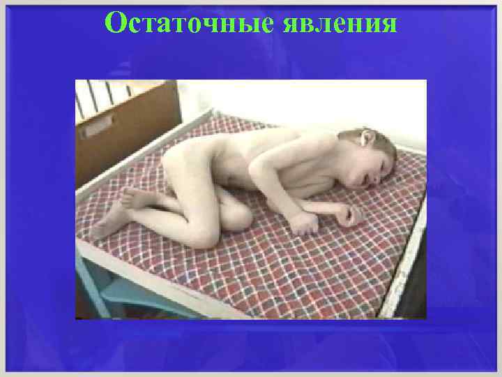 Остаточные явления 