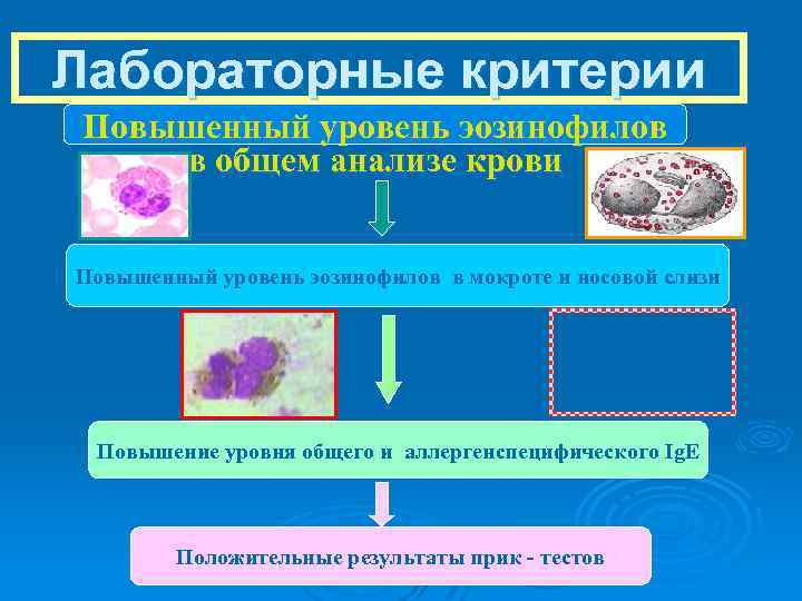 Лабораторные критерии Повышенный уровень эозинофилов в общем анализе крови Повышенный уровень эозинофилов в мокроте