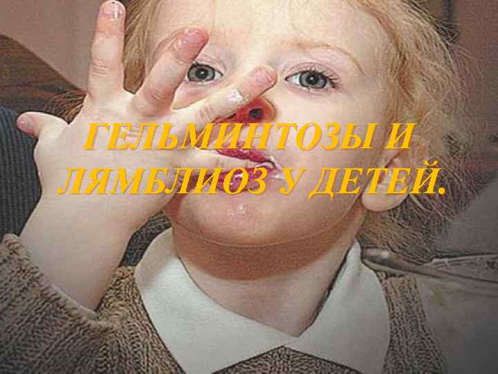  ГЕЛЬМИНТОЗЫ И ЛЯМБЛИОЗ У ДЕТЕЙ. 