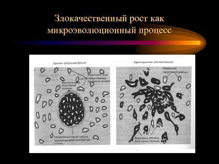 Злокачественный рост как микроэволюционный процесс 